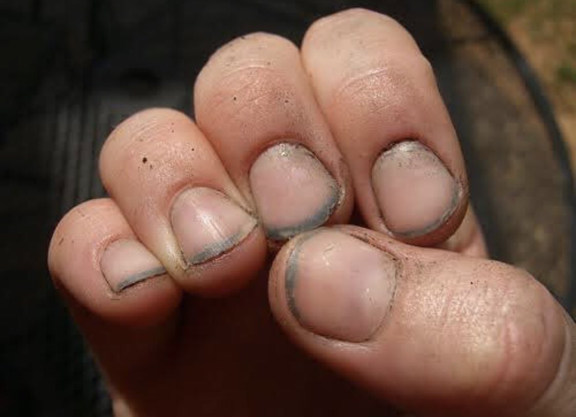 Детский маникюр на обгрызанные ногти