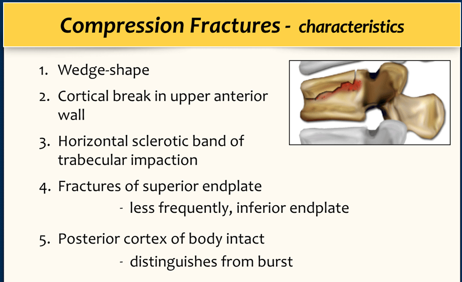 What causes compression fractures: Spinal Compression Fractures ...