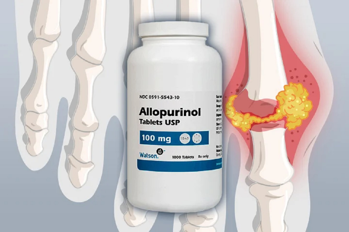 Лекарство от подагры аллопуринол