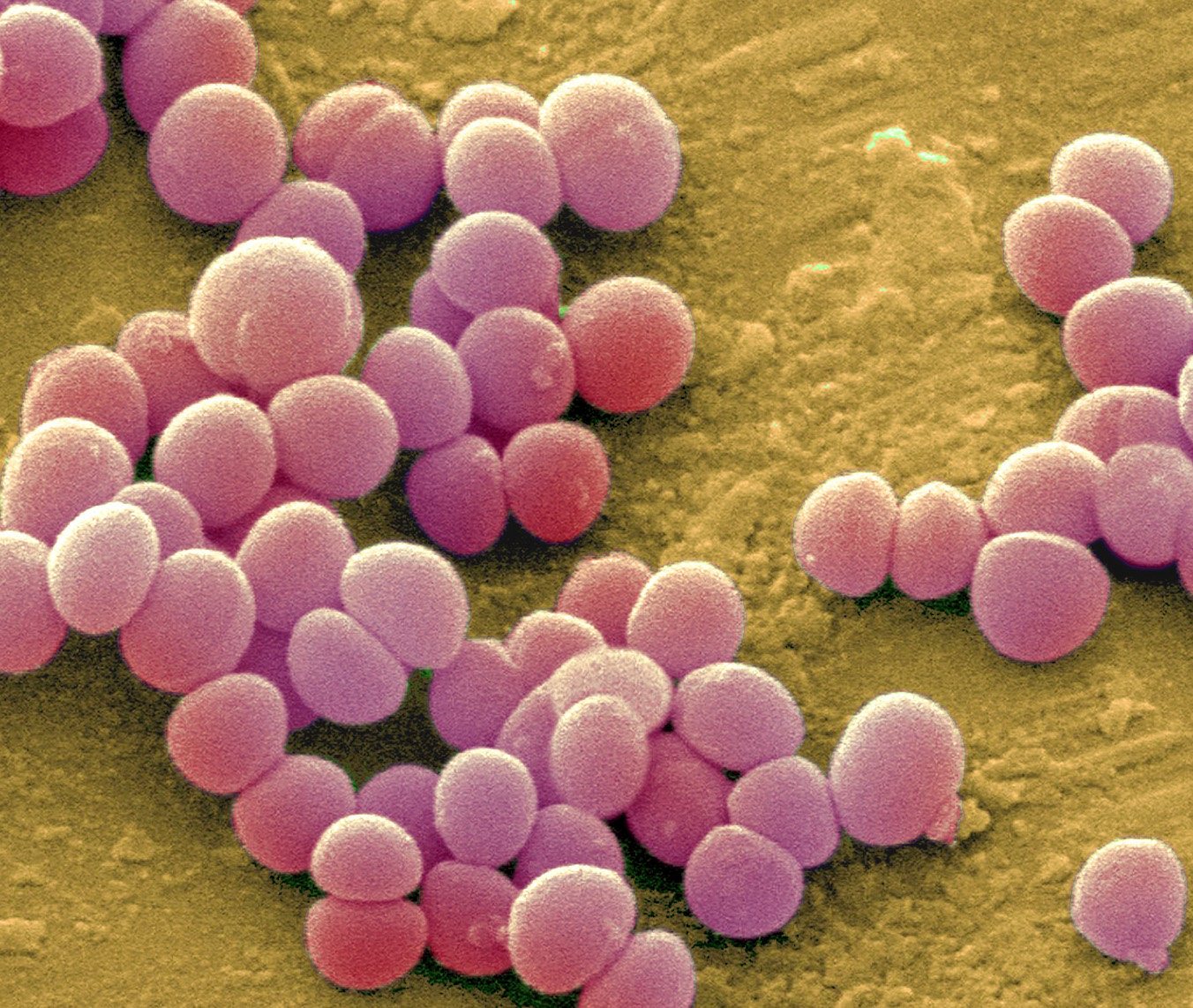Staphylococcus aureus 3. Стафилококк золотистый Staphylococcus aureus. Золотистый стафилококк и стрептококк. S. aureus золотистый стафилококк. Стафилококк ауреус болезни.
