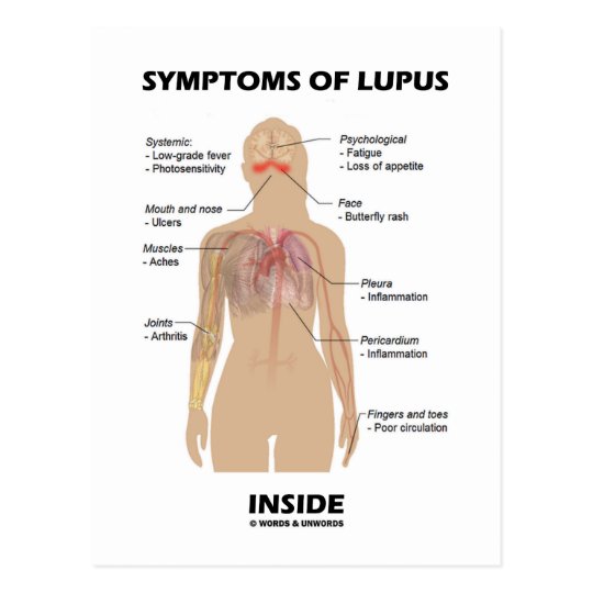 Lupus est перевод