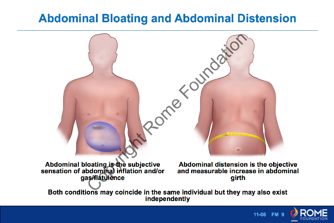 Distension abdominal dolor