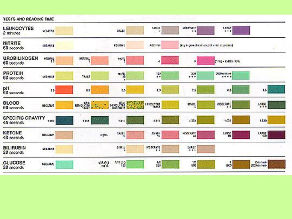 Urinalysis readings: Reference Range, Interpretation, Collection and ...