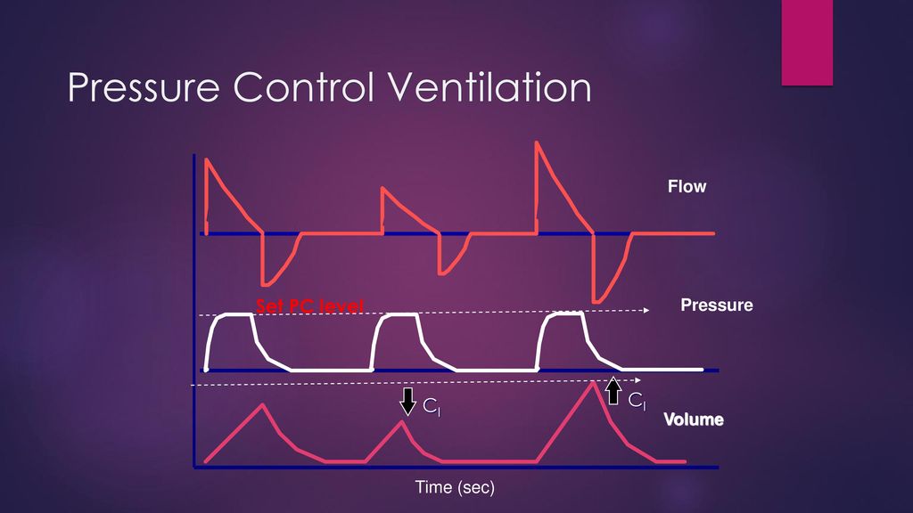 Volume support. Pressure Control Ventilation. Pressure Control Ventilation режим. Mechanical Ventilation Modes. Volume Control Ventilation.