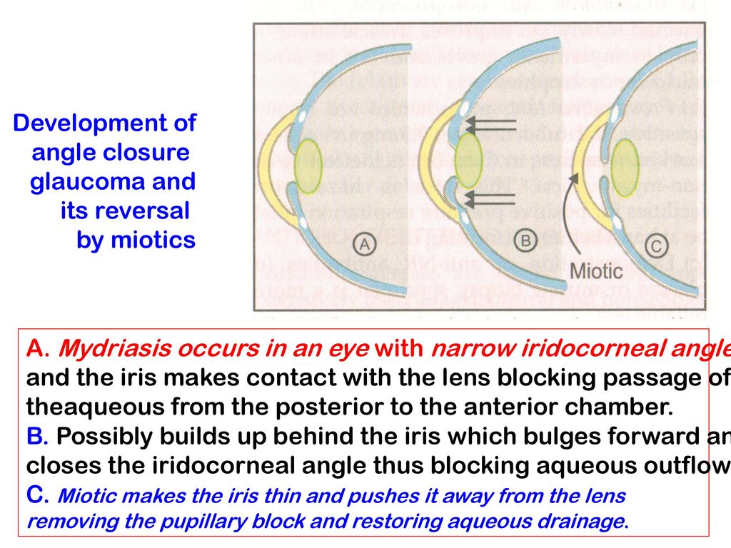 Глаукома латынь. Глаукома клапан Ахмеда. Iridocorneal Angle.
