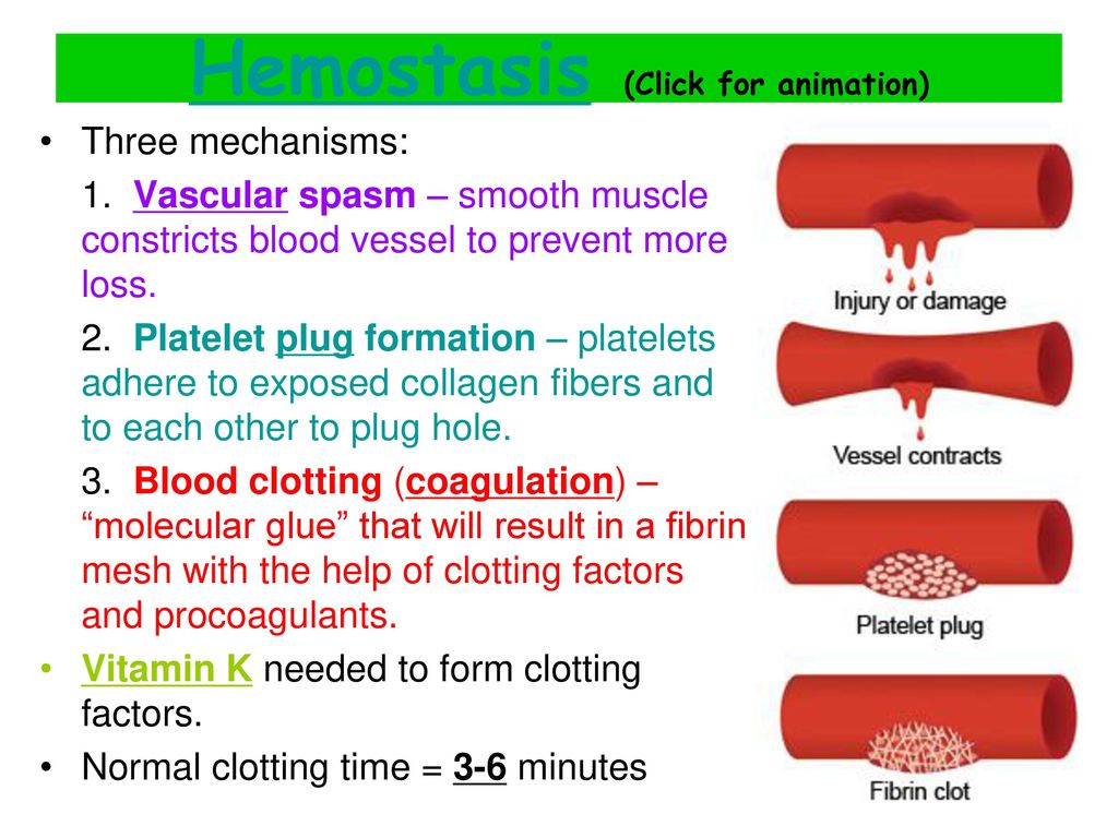 Atherosclerosis: Understanding Blood Vessel Hardening, Risks, and ...