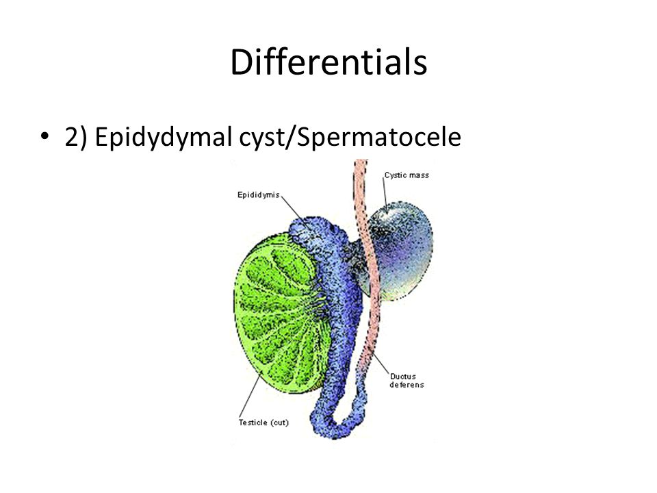 Cysts that smell: Sebaceous Cysts: Treatment & Cause