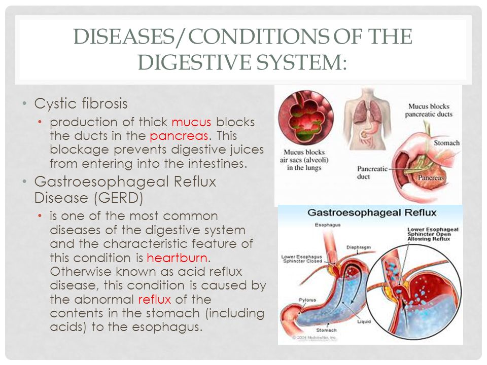 What Are Diseases That Affect The Digestive System Digestive Diseases Medlineplus Medical