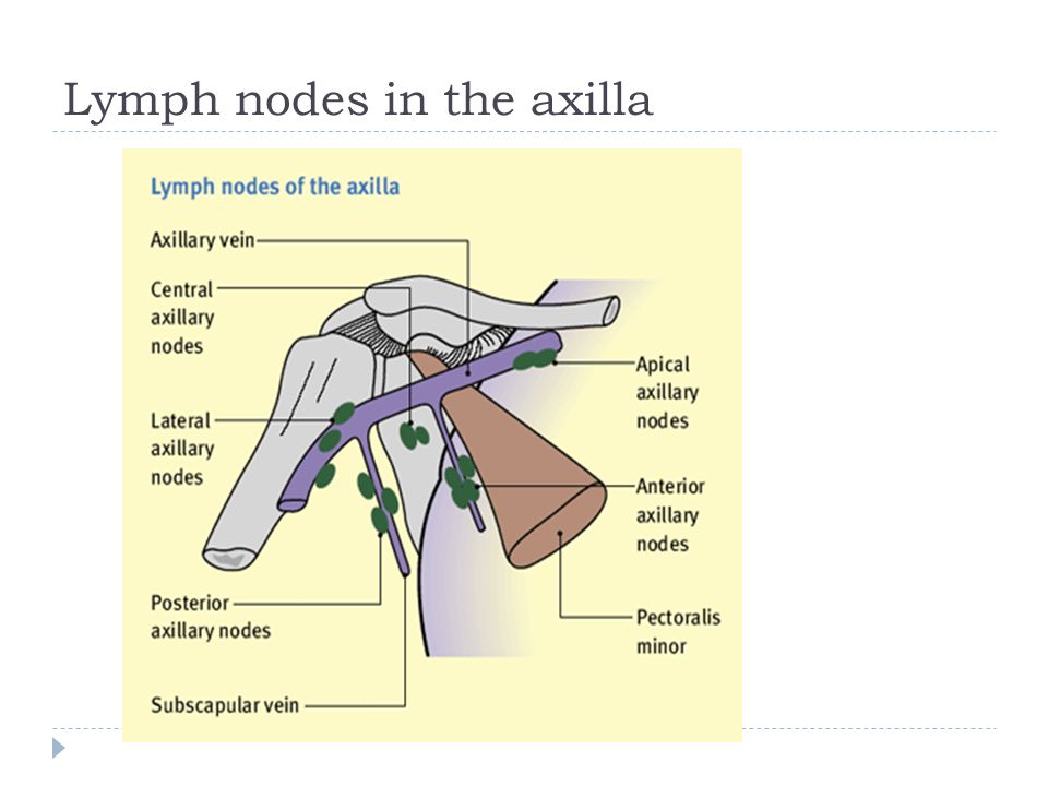 What Cause Lymph Nodes In The Neck Swollen Lymph Nodes Information