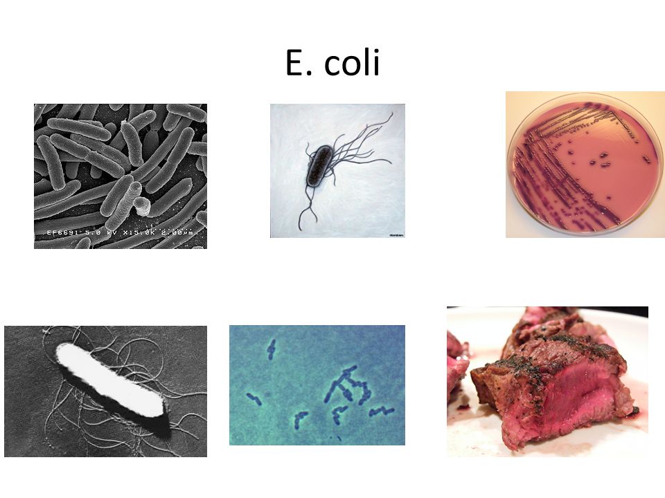 Coli sotwe. Штаммов e. coli рисунок. Эшерихии клиническая картина. Bacillafilla — строительный микроб.