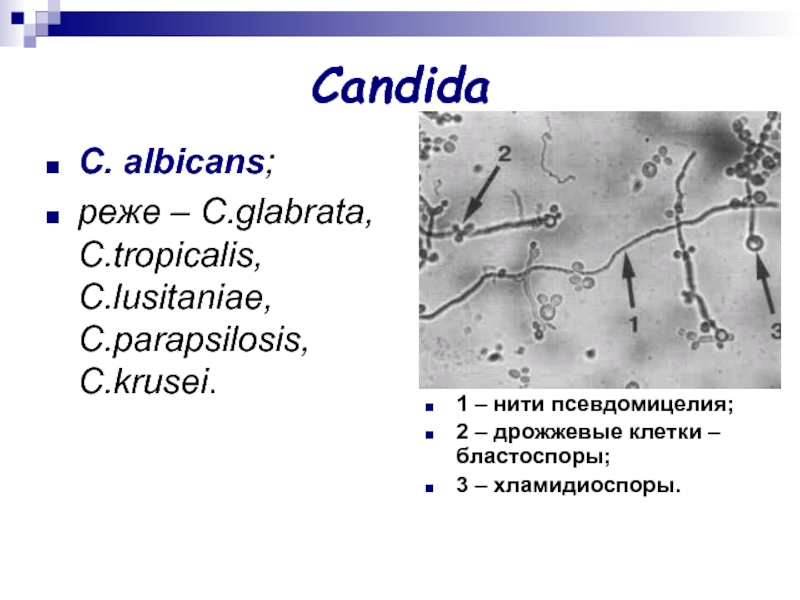 Candida albicans лечение. Колонии кандида альбиканс.