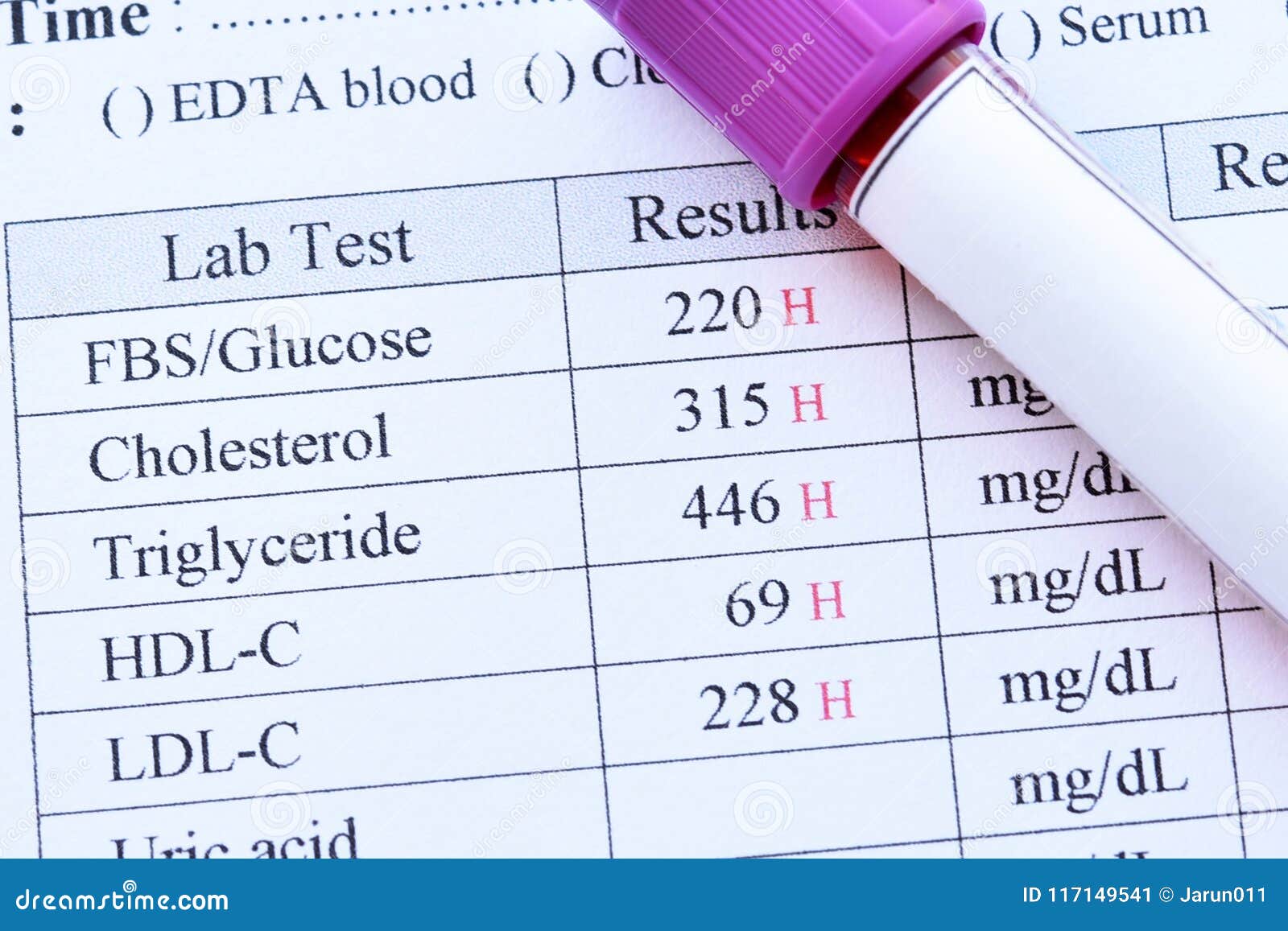 Какая ты кровь тест. Blood Test Results. Cholesterol Test Result. Baseline Blood Sugar. General Blood Test Translate.