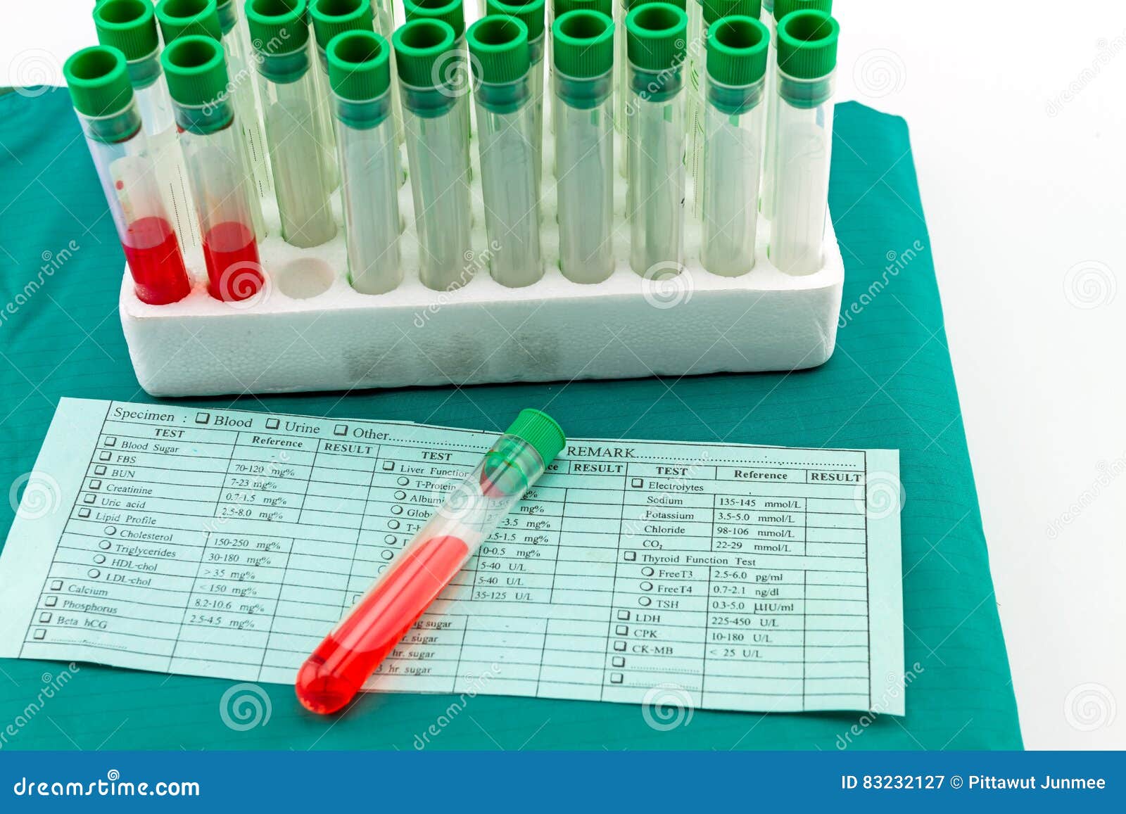 Какая ты кровь тест. Общий анализ крови пробирка. Пробирка для забора крови общий анализ крови. Пробирки с кровью и бланки. Алкоголь в пробирках.