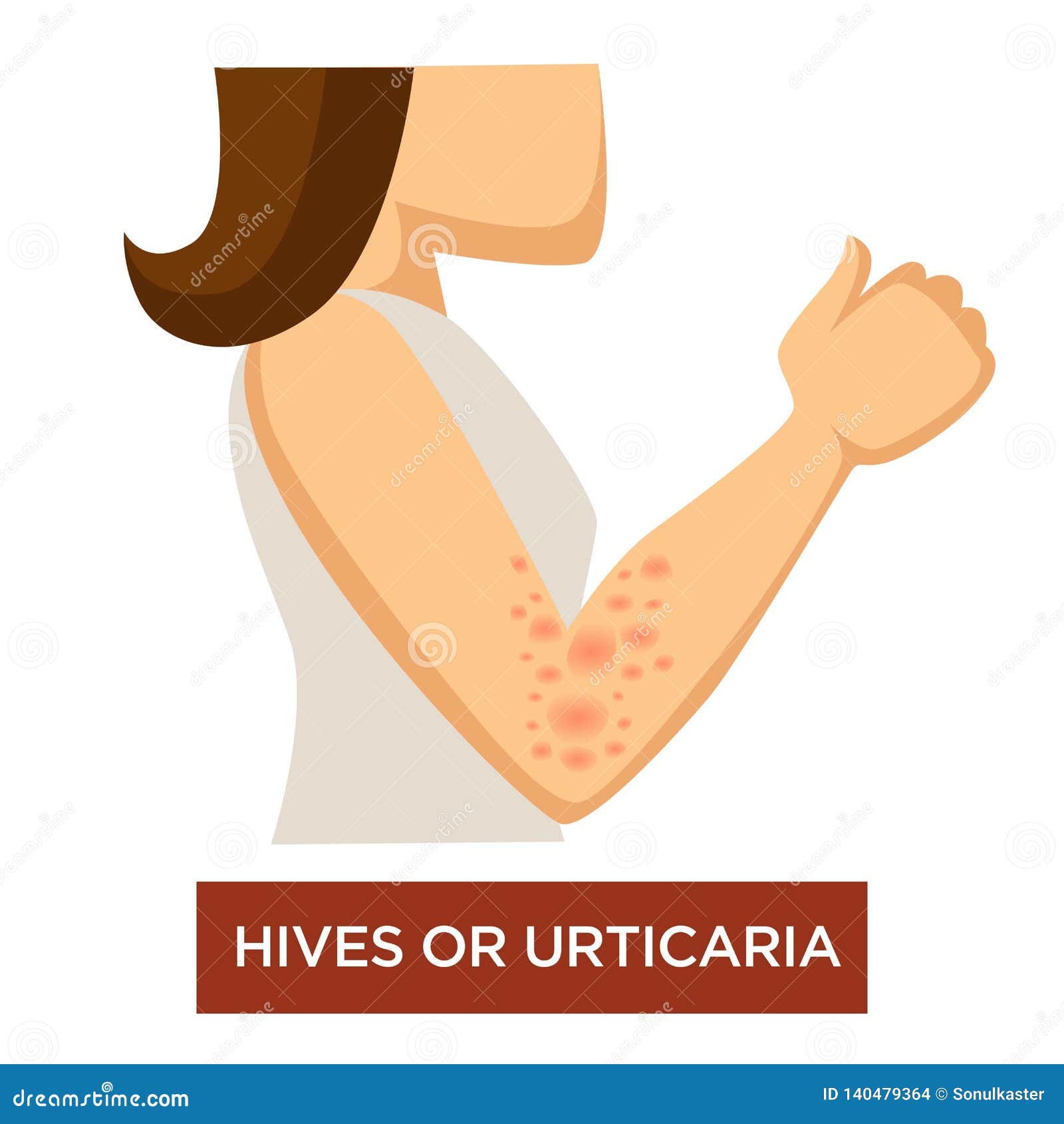 Skin rash on hands pictures Causes, 71 pictures of symptoms, and