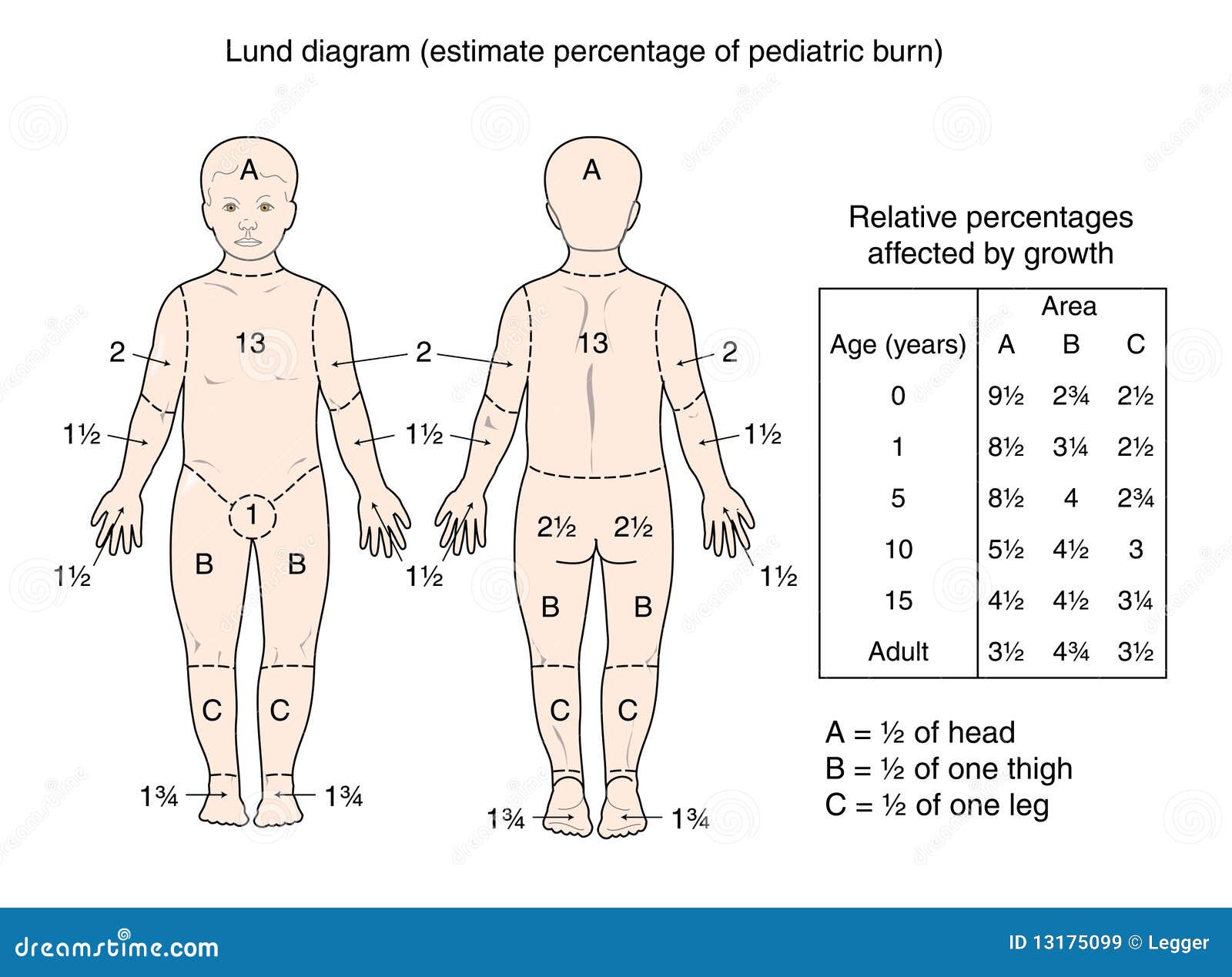 Burn percentage diagram Burn Percentage in Adults Rule of Nines Chart
