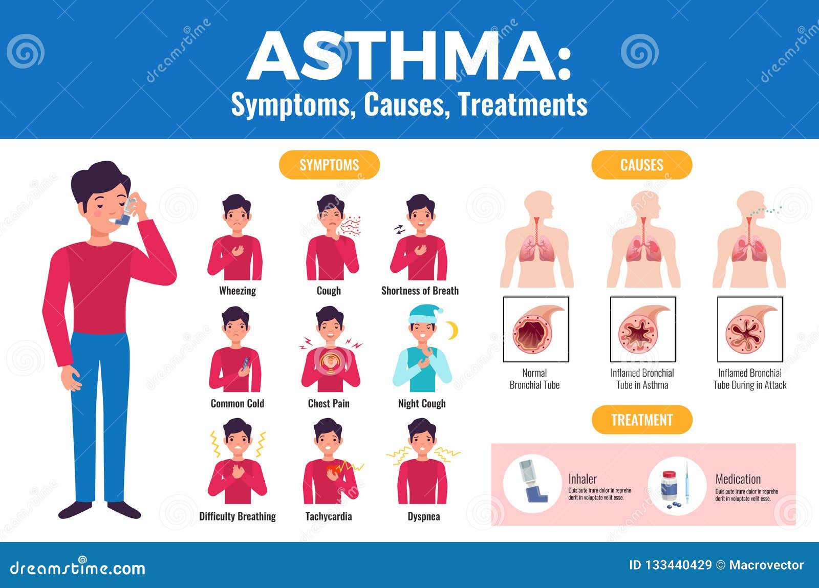 Wheezing at night with cough Nocturnal Asthma (Nighttime Asthma