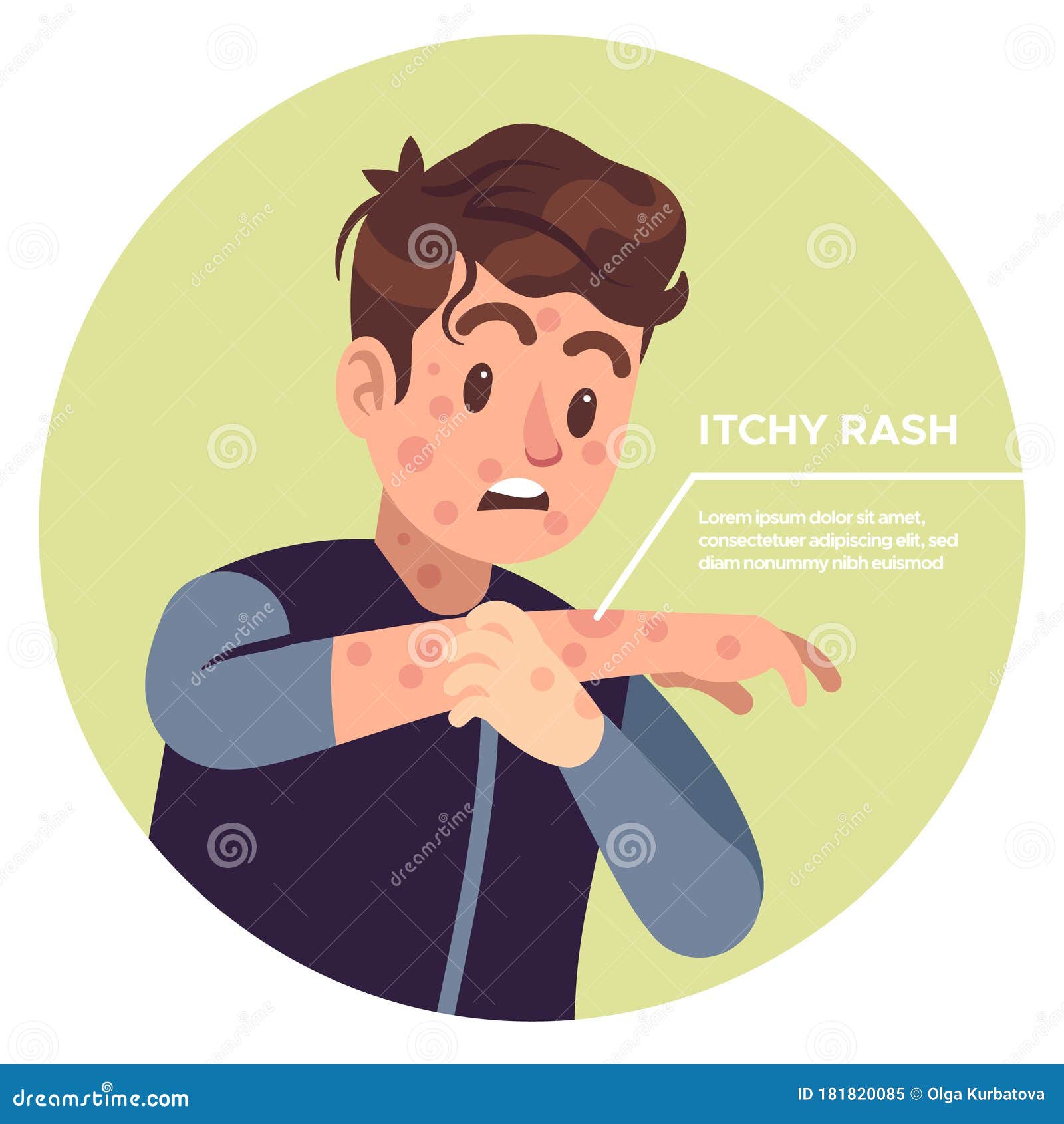 Itchy Fingers Causes, Symptoms, and Effective Treatments