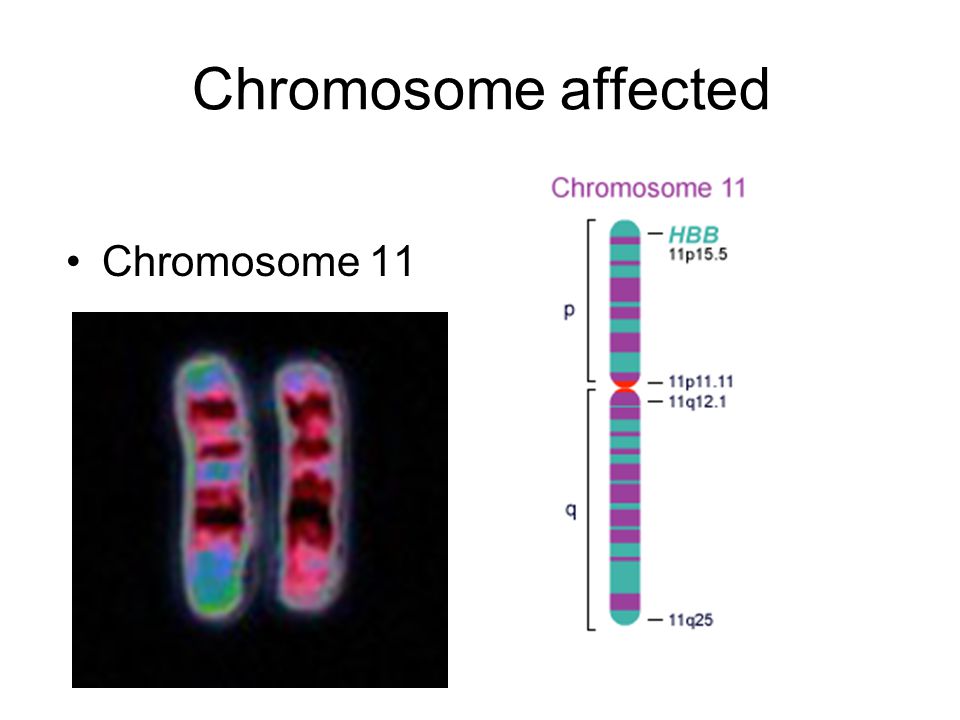 Двойные хромосомы. 11q13 хромосома. Локализация Гена инсулина на 11 хромосоме. 11p15.5 хромосома. Локализация Гена в хромосоме.