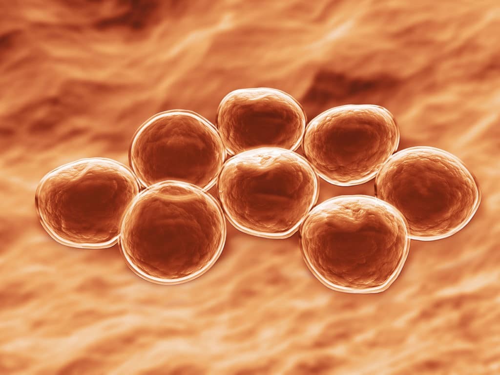 Staphylococcus aureus 4. Золотистый стафилококк MRSA. Метициллин бактерия. Метициллин-резистентный золотистый стафилококк. Золотистый стафилококк под микроскопом.