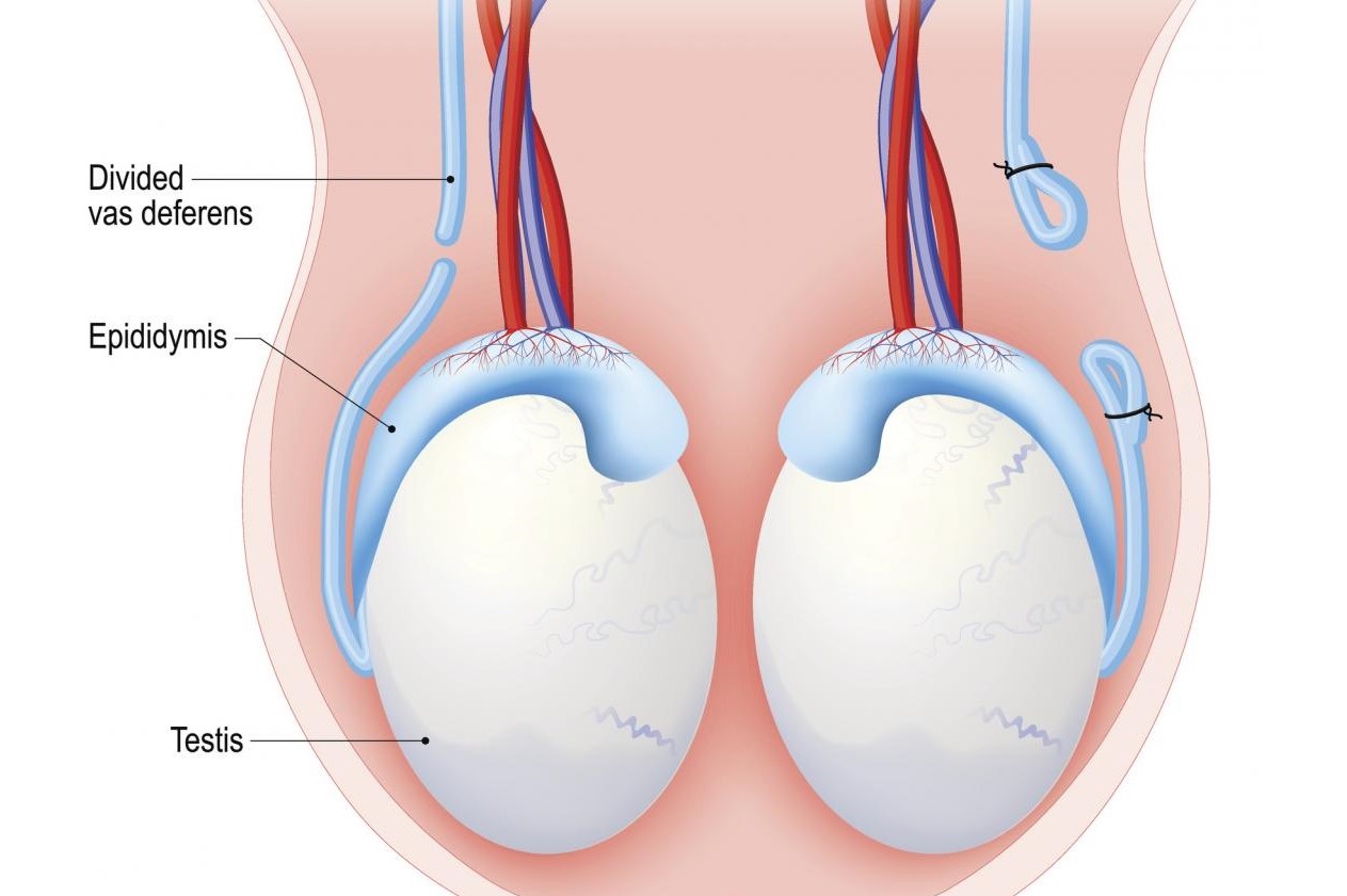 Левого яичка у мужчин