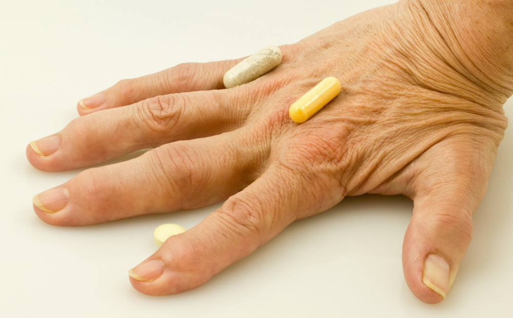 Ревматоидный артрит суставов кистей. Мазь от артрита кистей рук. Лекарство от артрита суставов пальцев. Лекарства от полиартрита пальцев.