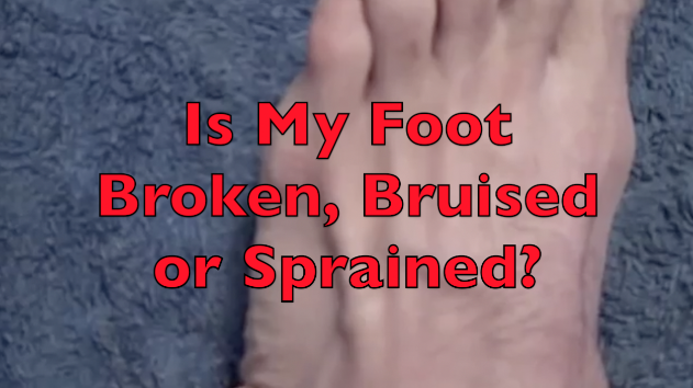 how-to-tell-if-your-toe-is-broken-or-sprained-the-request-could-not-be