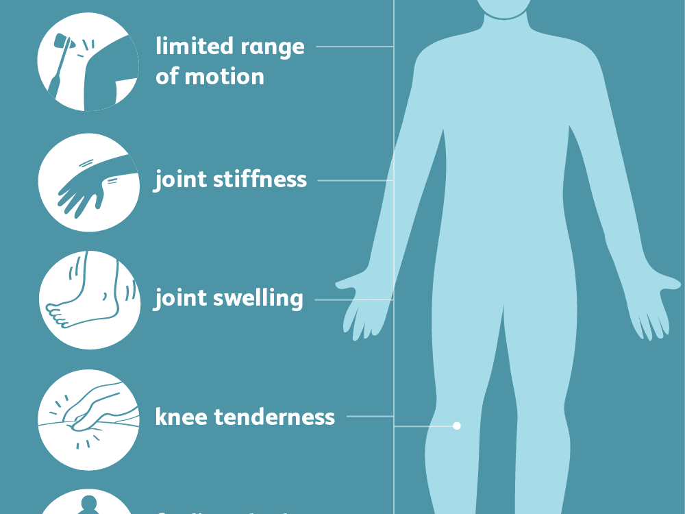 Swollen lymph nodes rheumatoid arthritis: Are Your Swollen Glands a