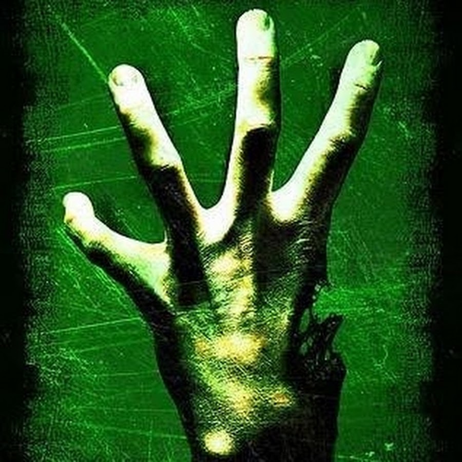 Infected sliver in finger Splinter, First Aid Condition, Treatments