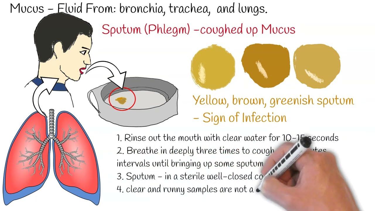 What Causes Phlegm Cough: Cough With Mucus: Causes, Symptoms, And ...