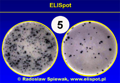 Fifth (and last) step of ELISpot